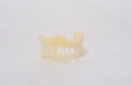 TC100 Temporary Crown & Bridge Resin - pryskyřice pro zubní modelovaní 1 kg